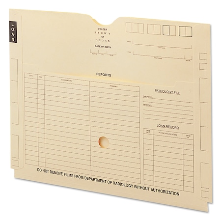 Smead X-Ray End Tab File Jacket w/Pocket, PK100 66300